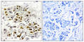 Mitogen-Activated Protein Kinase Kinase Kinase 6 antibody, abx013341, Abbexa, Western Blot image 