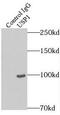 Ubiquitin Specific Peptidase 1 antibody, FNab09302, FineTest, Immunoprecipitation image 