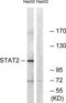 Signal Transducer And Activator Of Transcription 2 antibody, LS-C117580, Lifespan Biosciences, Western Blot image 