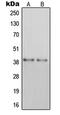 Purinergic Receptor P2Y14 antibody, LS-C353217, Lifespan Biosciences, Western Blot image 