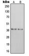 P2Y purinoceptor 14 antibody, LS-C353217, Lifespan Biosciences, Western Blot image 