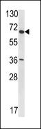 Ubiquitin Specific Peptidase 33 antibody, 61-123, ProSci, Western Blot image 