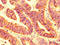 Plexin B1 antibody, LS-C671471, Lifespan Biosciences, Immunohistochemistry paraffin image 