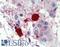 Chymase 1 antibody, LS-B4134, Lifespan Biosciences, Immunohistochemistry frozen image 
