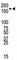 Insulin Receptor antibody, F50643-0.4ML, NSJ Bioreagents, Immunohistochemistry paraffin image 