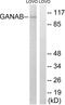 Glucosidase II Alpha Subunit antibody, LS-C198991, Lifespan Biosciences, Western Blot image 