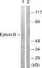 Ephrin B1 antibody, GTX87381, GeneTex, Western Blot image 
