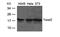 Twist-related protein 2 antibody, TA347852, Origene, Western Blot image 