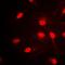 Transcription Factor AP-2 Alpha antibody, orb214653, Biorbyt, Immunofluorescence image 