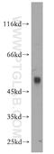 Zinc Finger FYVE-Type Containing 27 antibody, 12680-1-AP, Proteintech Group, Western Blot image 