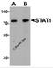 Signal Transducer And Activator Of Transcription 1 antibody, 7195, ProSci, Western Blot image 