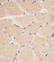 Density Regulated Re-Initiation And Release Factor antibody, M06362, Boster Biological Technology, Immunohistochemistry paraffin image 