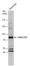 Phosphatase And Actin Regulator 1 antibody, PA5-35948, Invitrogen Antibodies, Western Blot image 