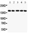 Collagen Type II Alpha 1 Chain antibody, PA2141, Boster Biological Technology, Western Blot image 