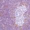 DNA Nucleotidylexotransferase antibody, PA5-32610, Invitrogen Antibodies, Immunohistochemistry paraffin image 