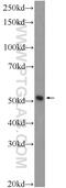 GDP-D-Glucose Phosphorylase 1 antibody, 25447-1-AP, Proteintech Group, Western Blot image 