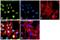 Ubiquitin Specific Peptidase 7 antibody, PA5-17179, Invitrogen Antibodies, Immunofluorescence image 