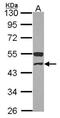 Glutaryl-CoA Dehydrogenase antibody, NBP2-16622, Novus Biologicals, Western Blot image 