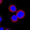 Interferon Regulatory Factor 5 antibody, AF4508, R&D Systems, Immunofluorescence image 