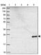 NADH:Ubiquinone Oxidoreductase Subunit B9 antibody, PA5-60110, Invitrogen Antibodies, Western Blot image 