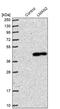 Lectin, Mannose Binding 2 antibody, PA5-52027, Invitrogen Antibodies, Western Blot image 