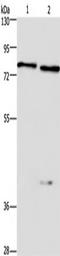 Collagen Type IV Alpha 3 Binding Protein antibody, TA349819, Origene, Western Blot image 