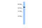 Zinc Finger Protein 514 antibody, 29-117, ProSci, Enzyme Linked Immunosorbent Assay image 