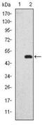 DLG Associated Protein 1 antibody, MA5-15874, Invitrogen Antibodies, Western Blot image 