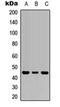 Interleukin 1 Receptor Type 2 antibody, orb256621, Biorbyt, Western Blot image 