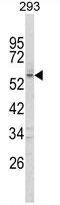 Forkhead Box C1 antibody, GTX80948, GeneTex, Western Blot image 