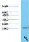 Transthyretin antibody, STJ98877, St John