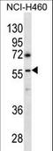 Gamma-Aminobutyric Acid Type A Receptor Rho3 Subunit (Gene/Pseudogene) antibody, LS-C166399, Lifespan Biosciences, Western Blot image 