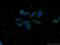 Clathrin Light Chain B antibody, 66270-1-Ig, Proteintech Group, Immunofluorescence image 