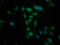5'-Nucleotidase, Cytosolic II antibody, LS-C673416, Lifespan Biosciences, Immunofluorescence image 