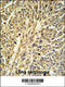 Inosine Monophosphate Dehydrogenase 2 antibody, 62-875, ProSci, Immunohistochemistry paraffin image 