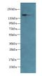 ADAM Metallopeptidase With Thrombospondin Type 1 Motif 7 antibody, LS-C380216, Lifespan Biosciences, Western Blot image 