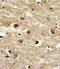 Insulin Like Growth Factor Binding Protein 2 antibody, PA5-35343, Invitrogen Antibodies, Immunohistochemistry paraffin image 