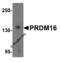 PR domain zinc finger protein 16 antibody, 5555, ProSci, Western Blot image 