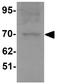 Anosmin 1 antibody, GTX32013, GeneTex, Western Blot image 
