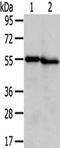 Transmembrane Serine Protease 5 antibody, CSB-PA036396, Cusabio, Western Blot image 