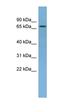 NADH:Ubiquinone Oxidoreductase Core Subunit S1 antibody, orb330870, Biorbyt, Western Blot image 