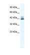 Zinc Finger Protein 551 antibody, NBP1-80139, Novus Biologicals, Western Blot image 
