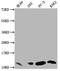 Macrophage Migration Inhibitory Factor antibody, CSB-RA146975A0HU, Cusabio, Western Blot image 