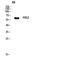 Fibroblast Growth Factor Receptor Substrate 2 antibody, A02798, Boster Biological Technology, Western Blot image 