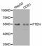 Phosphatase And Tensin Homolog antibody, STJ113173, St John