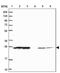 Ankyrin Repeat Domain 18A antibody, PA5-62367, Invitrogen Antibodies, Western Blot image 