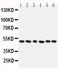 Histone Deacetylase 3 antibody, PA1600-1, Boster Biological Technology, Western Blot image 