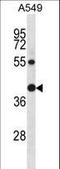 RAD23 Homolog B, Nucleotide Excision Repair Protein antibody, LS-C162407, Lifespan Biosciences, Western Blot image 