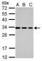 Tetraspanin 3 antibody, GTX106868, GeneTex, Western Blot image 