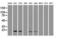 Adenylate Kinase 1 antibody, LS-C784197, Lifespan Biosciences, Western Blot image 
